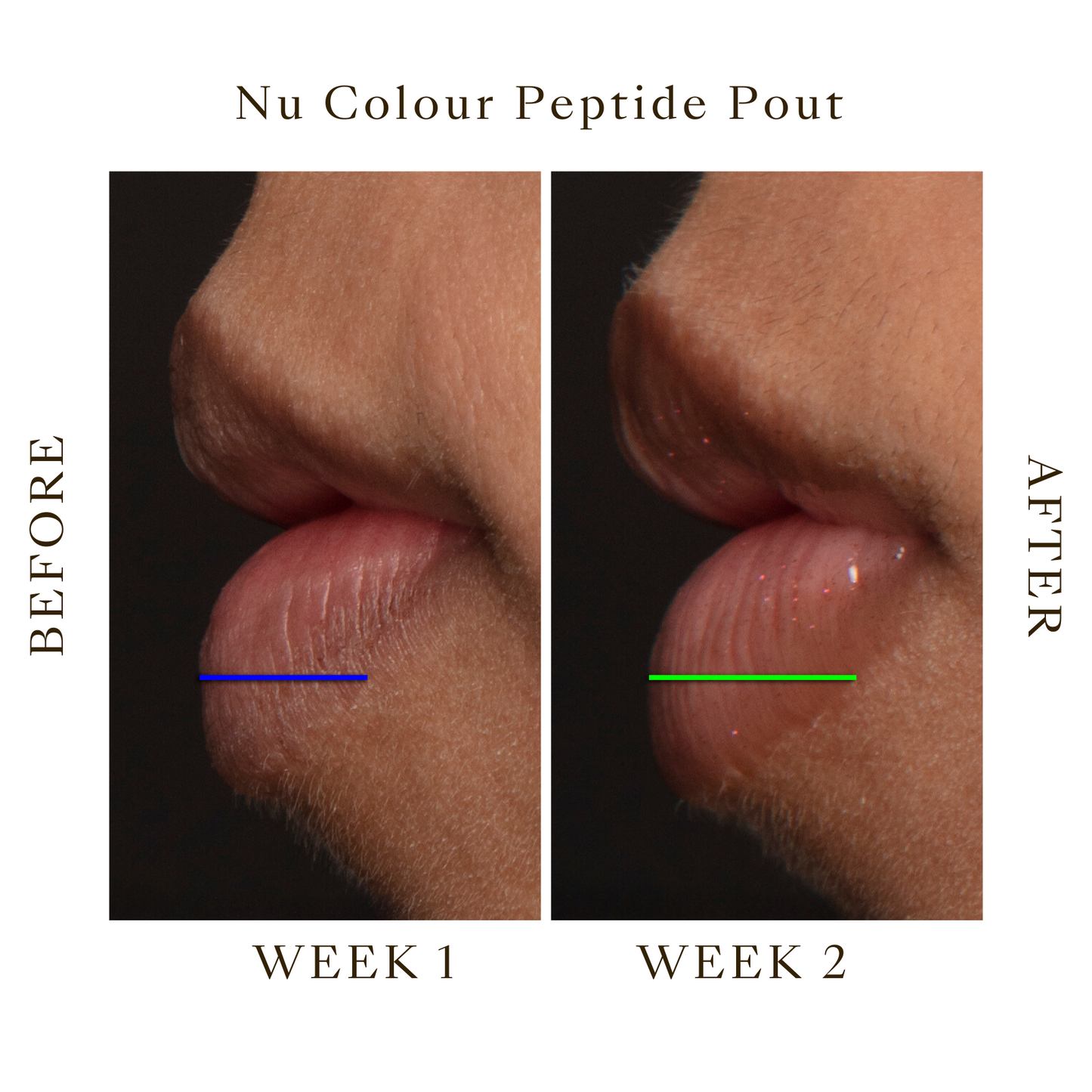 Lip Peptide Pout