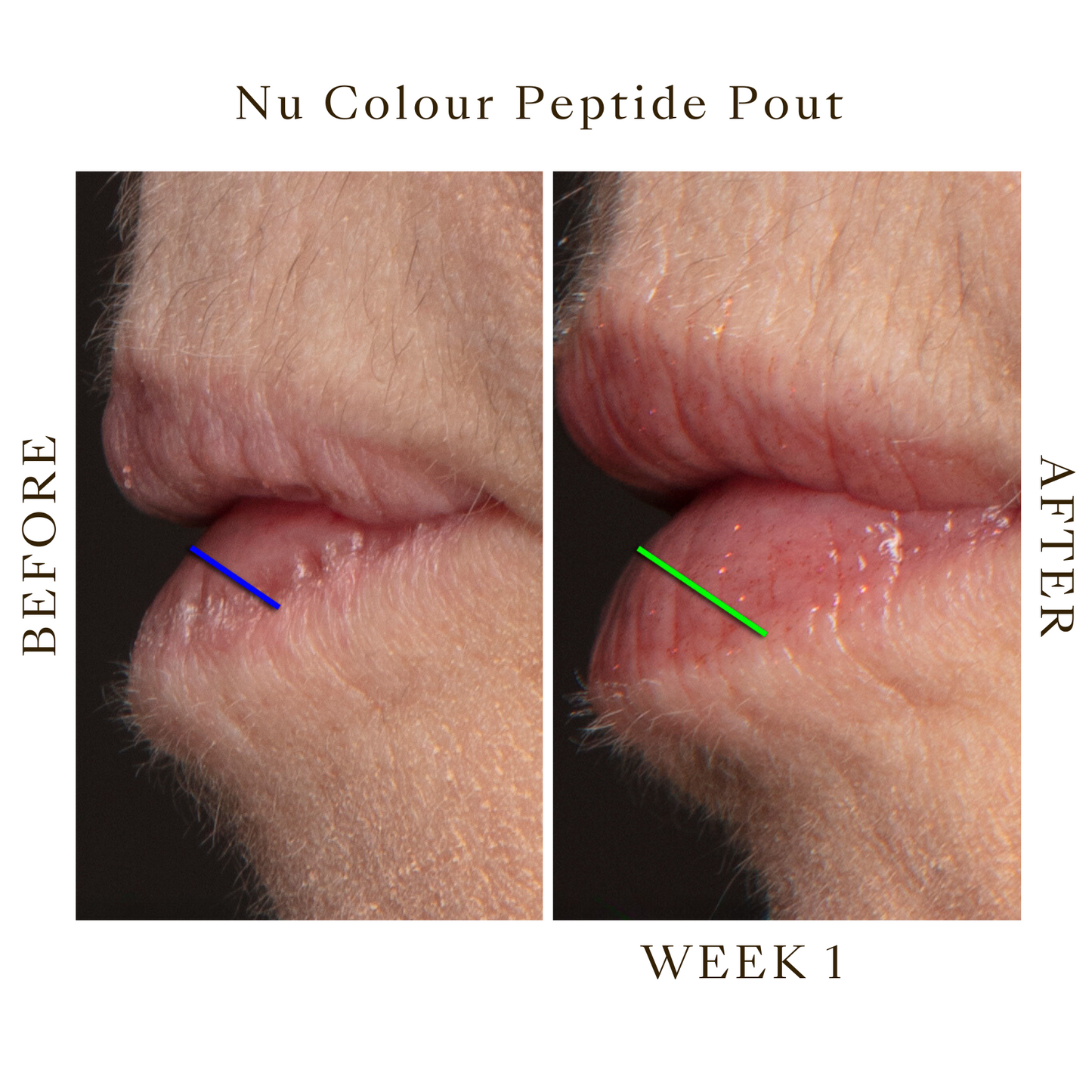 Lip Peptide Pout